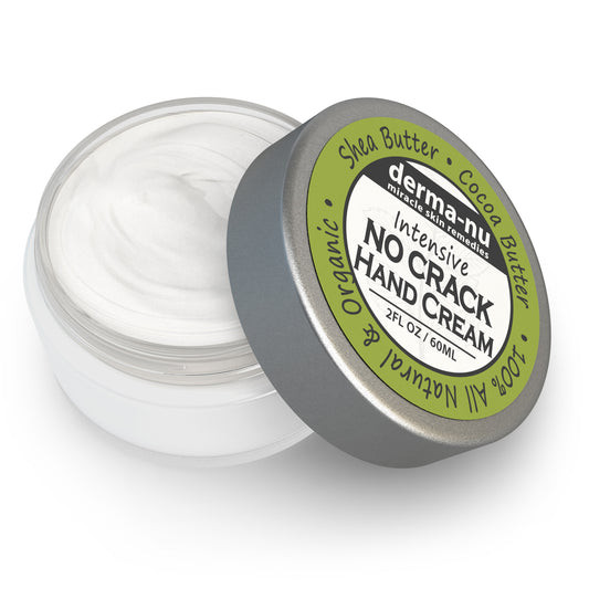 How to Prevent Dry, Cracked Hands